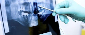 Dental X-rays