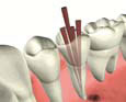 RCT Referrals North East