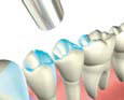RCT Dentistry